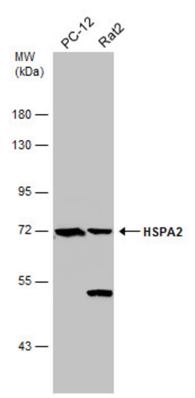 ANTI-HSPA2