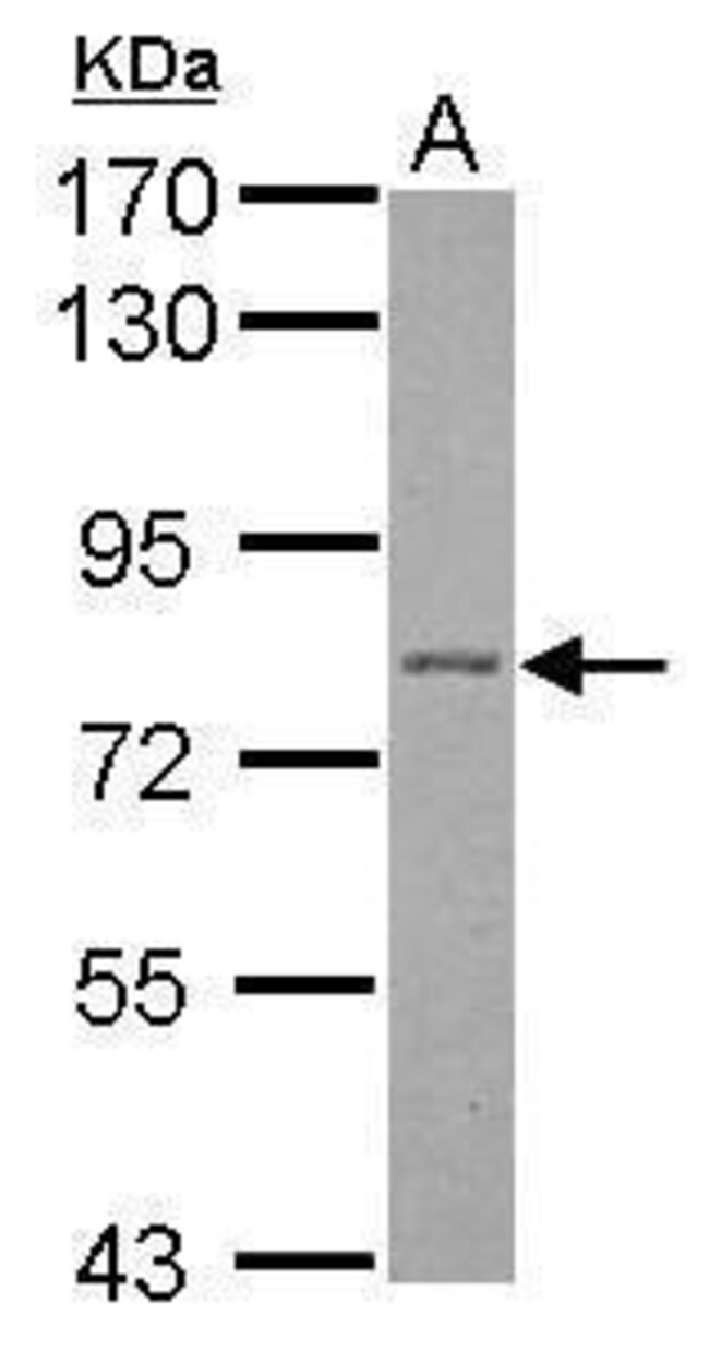 ANTI-PLAKOPHILIN 1