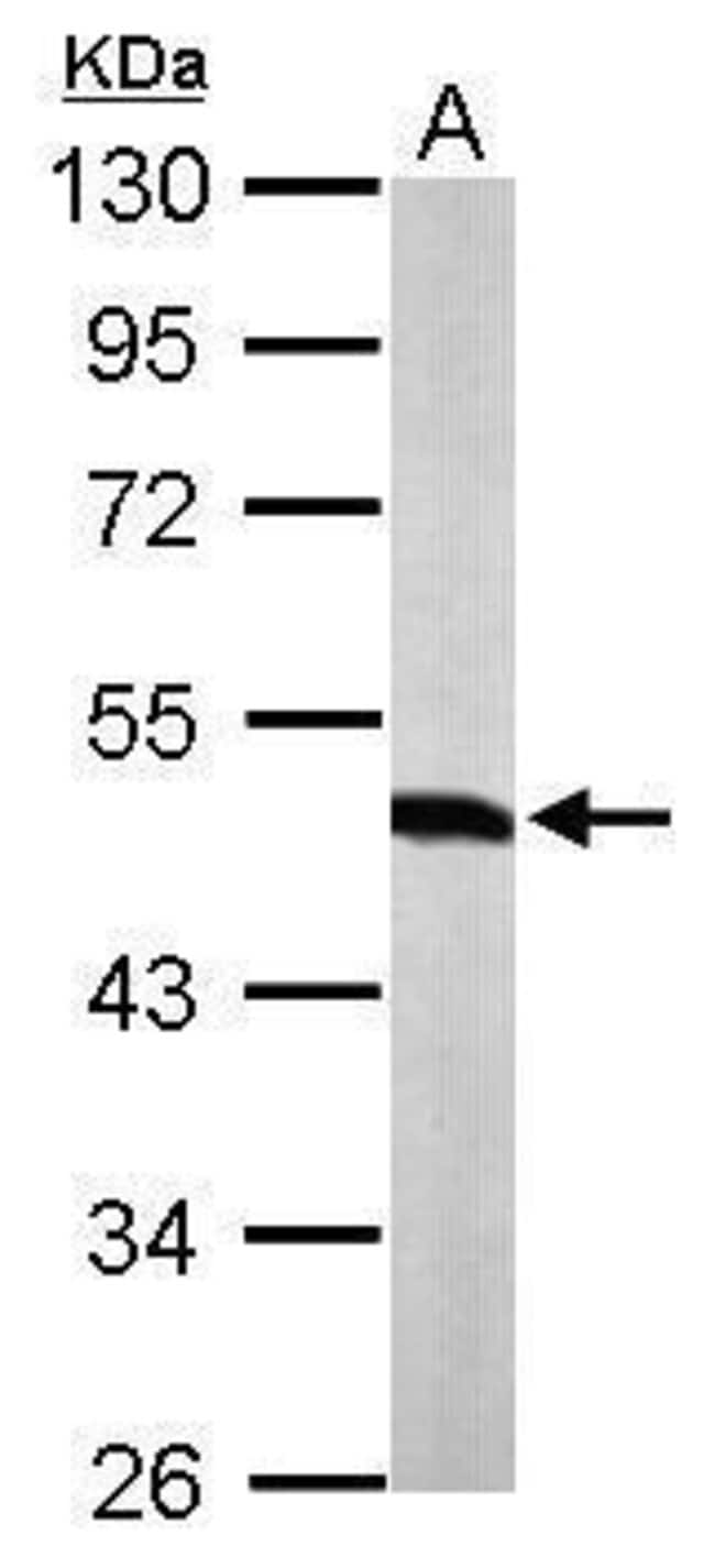 ANTI-TRYPTOPHANYL TRNA SYNTHETASE