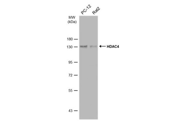 ANTI-HDAC4