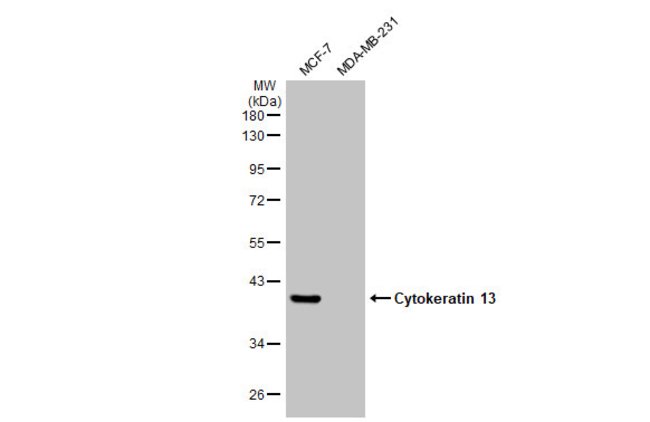 ANTI-CYTOKERATIN 13