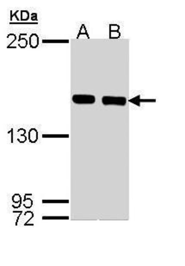 ANTI-SMC1A