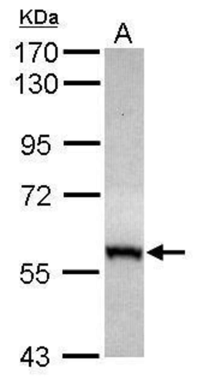 ANTI-CABC1