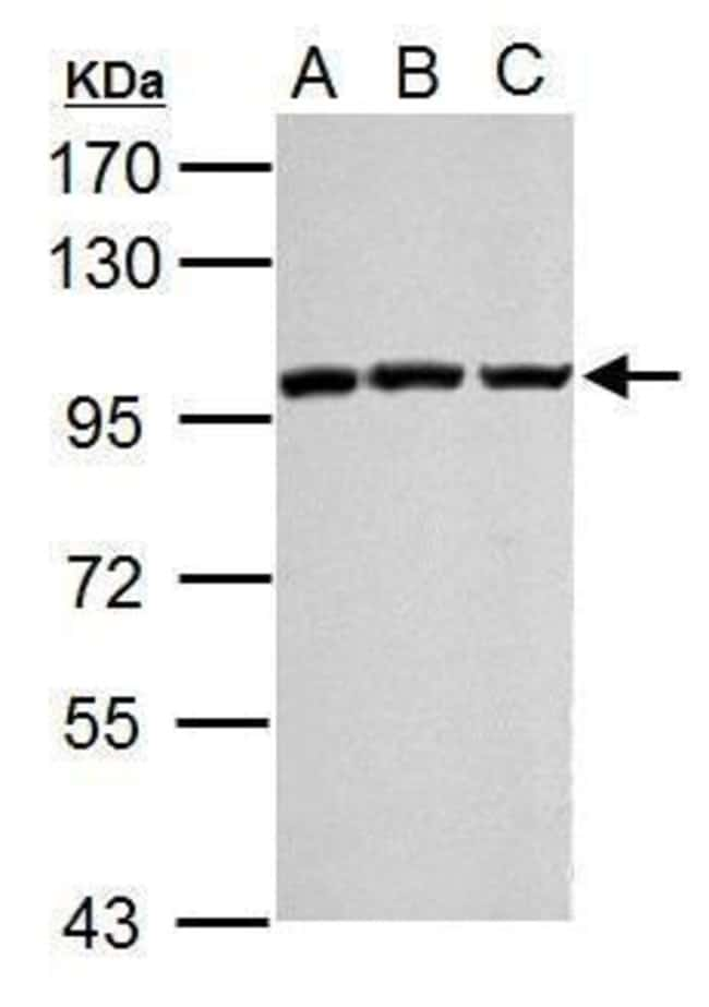 ANTI-EZH2/KMT6