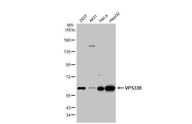 ANTI-VPS33B