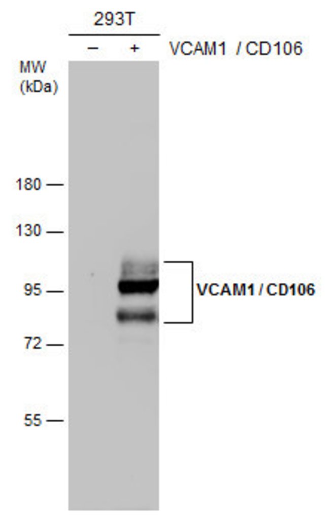 ANTI-VCAM1