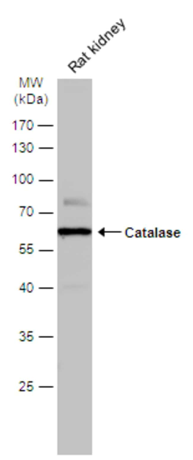 ANTI-CATALASE