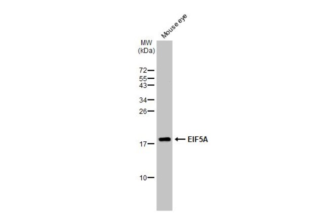 ANTI-EIF5A