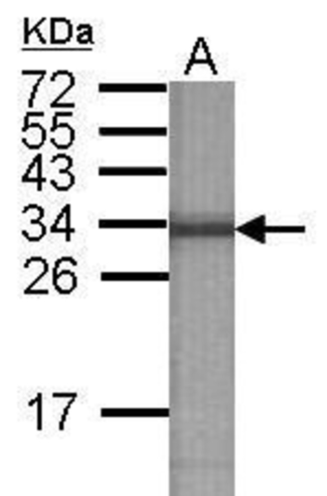 ANTI-ATP6V1E2