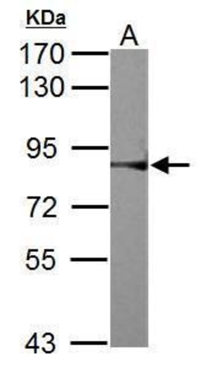 ANTI-RSK2