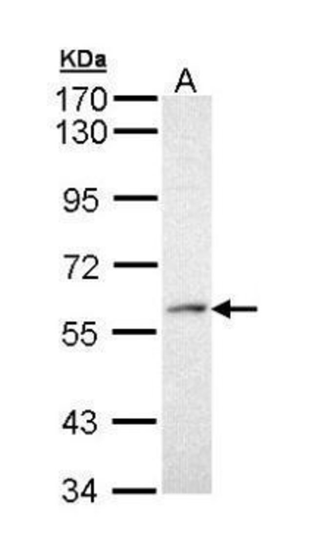 ANTI-PRP19