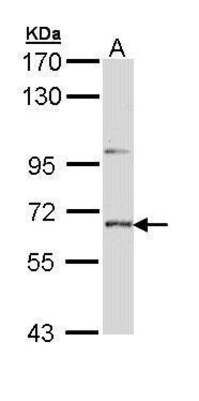 ANTI-STEP / PTPN5