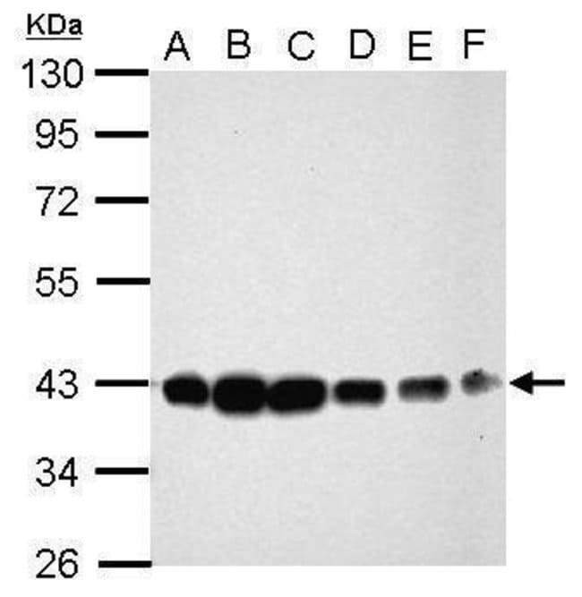 ANTI-CIAPIN1