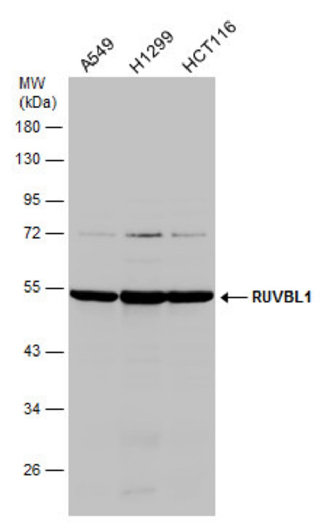 ANTI-RUVBL1