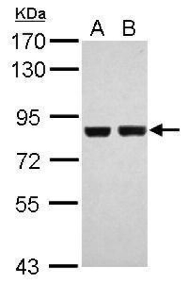 ANTI-RSK2