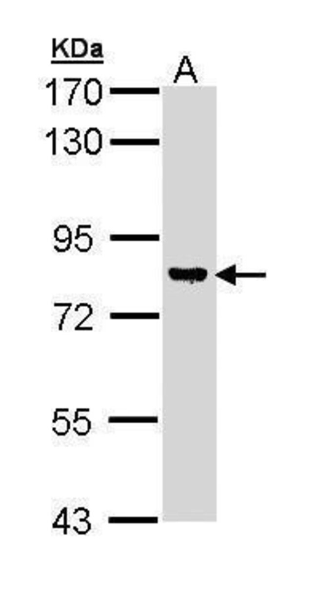 ANTI-DAG KINASE GAMMA