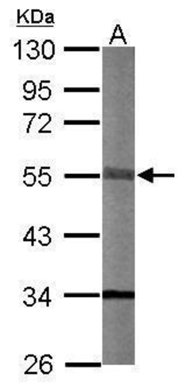 ANTI-STK40