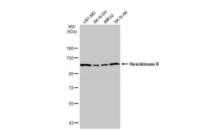 ANTI-HEXOKINASE II