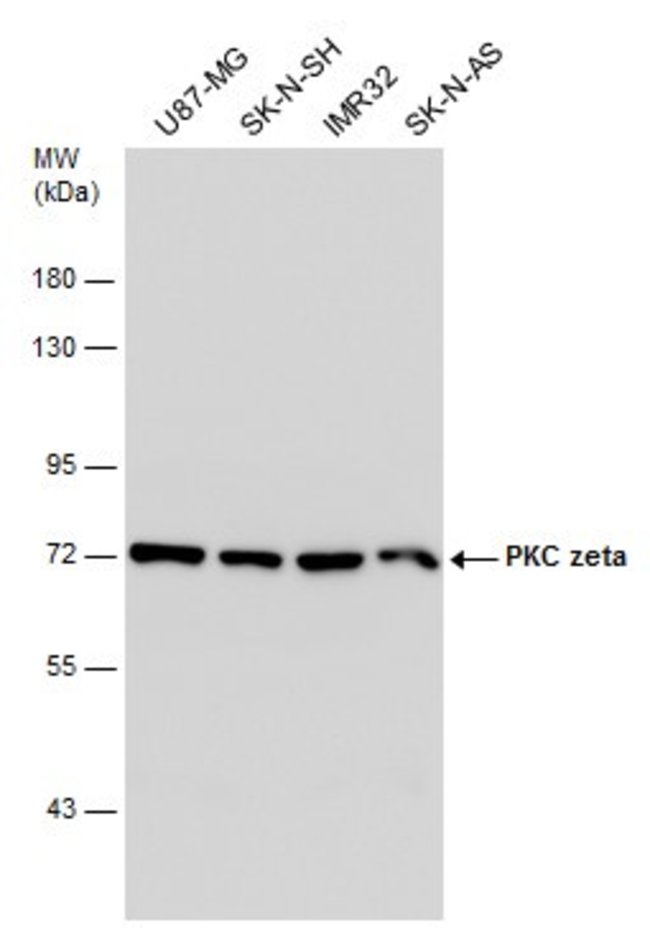 ANTI-PKC ZETA