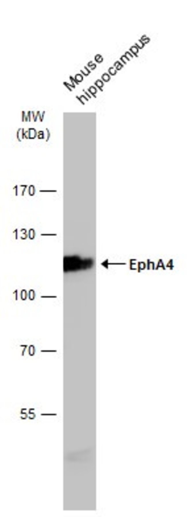 ANTI-EPH RECEPTOR A4