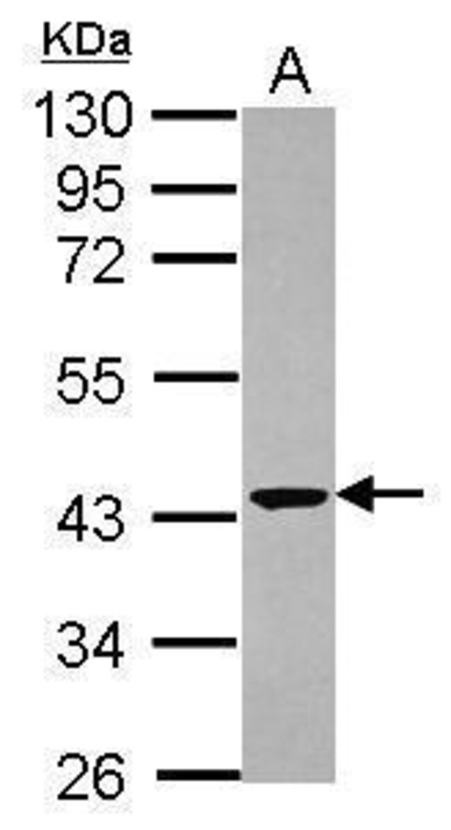 ANTI-CNP