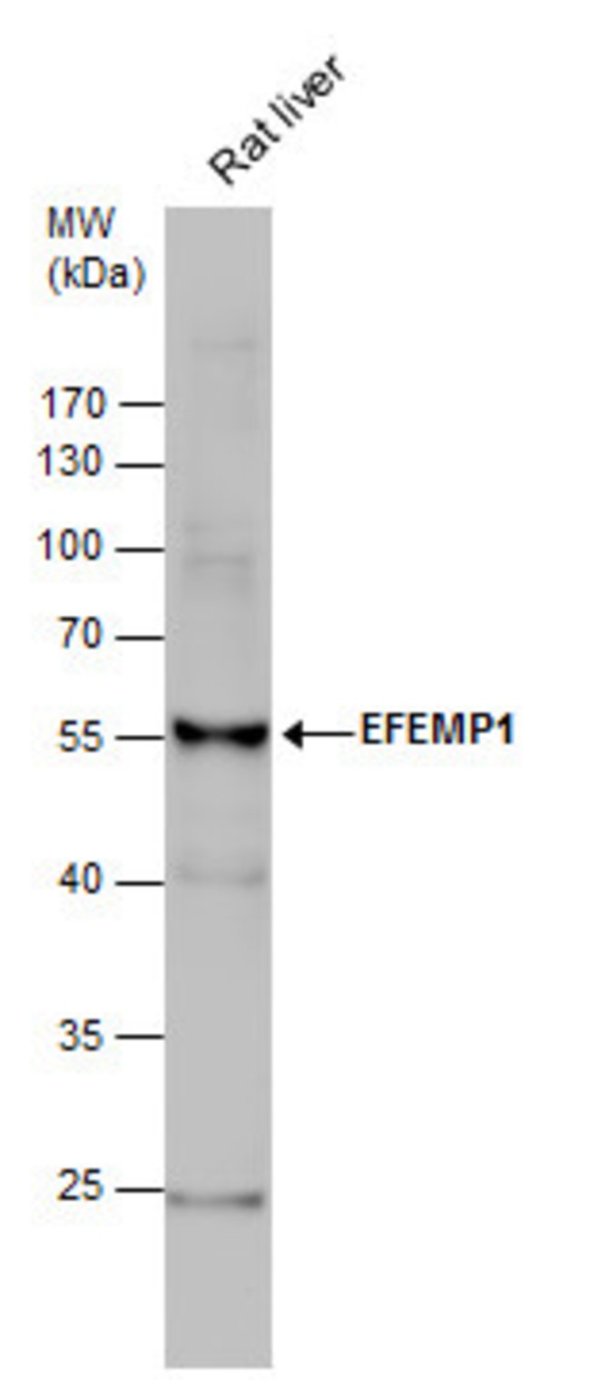 ANTI-FIBULIN 3