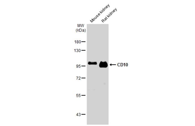 ANTI-CD10