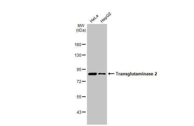 ANTI-TRANSGLUTAMINASE 2