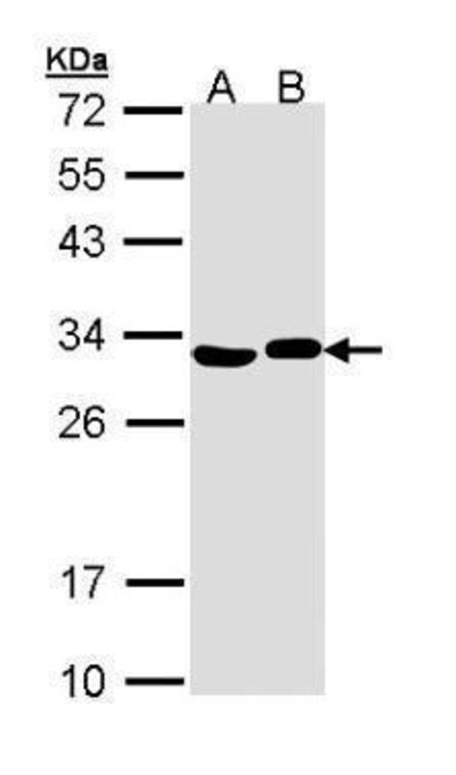 ANTI-ADENYLATE KINASE 2