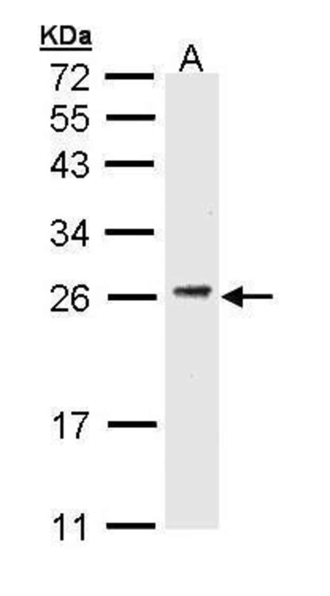 ANTI-CD3 GAMMA