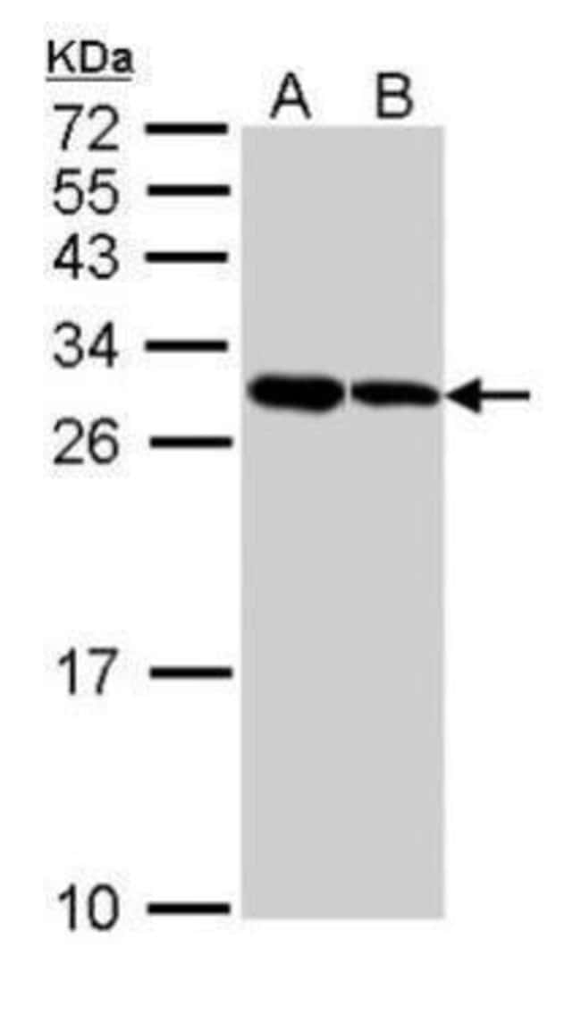 ANTI-NOL3