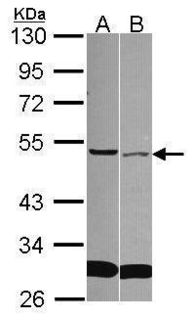 ANTI-FRP-4