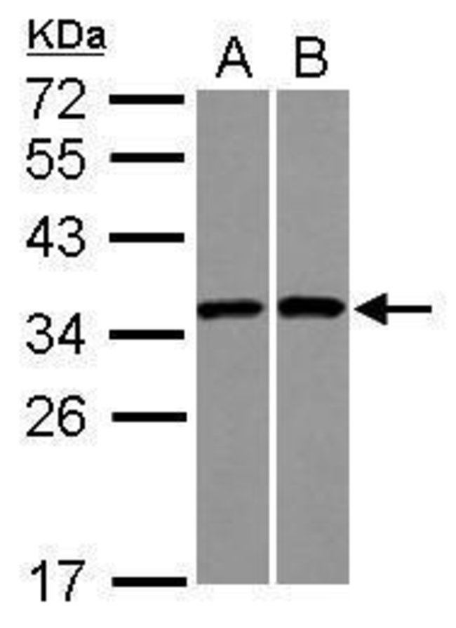 ANTI-RPS3A