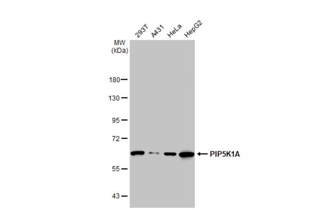 ANTI-PIP5K1A