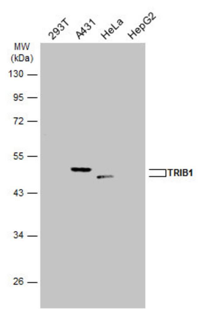 ANTI-TRIB1