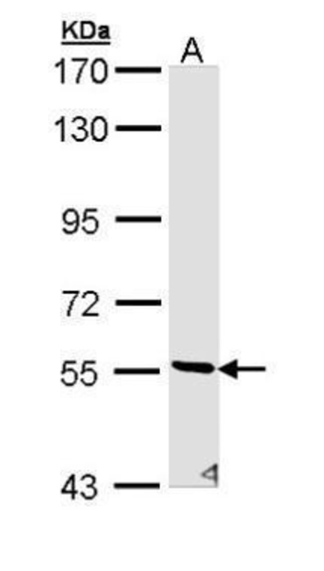 ANTI-STK32C