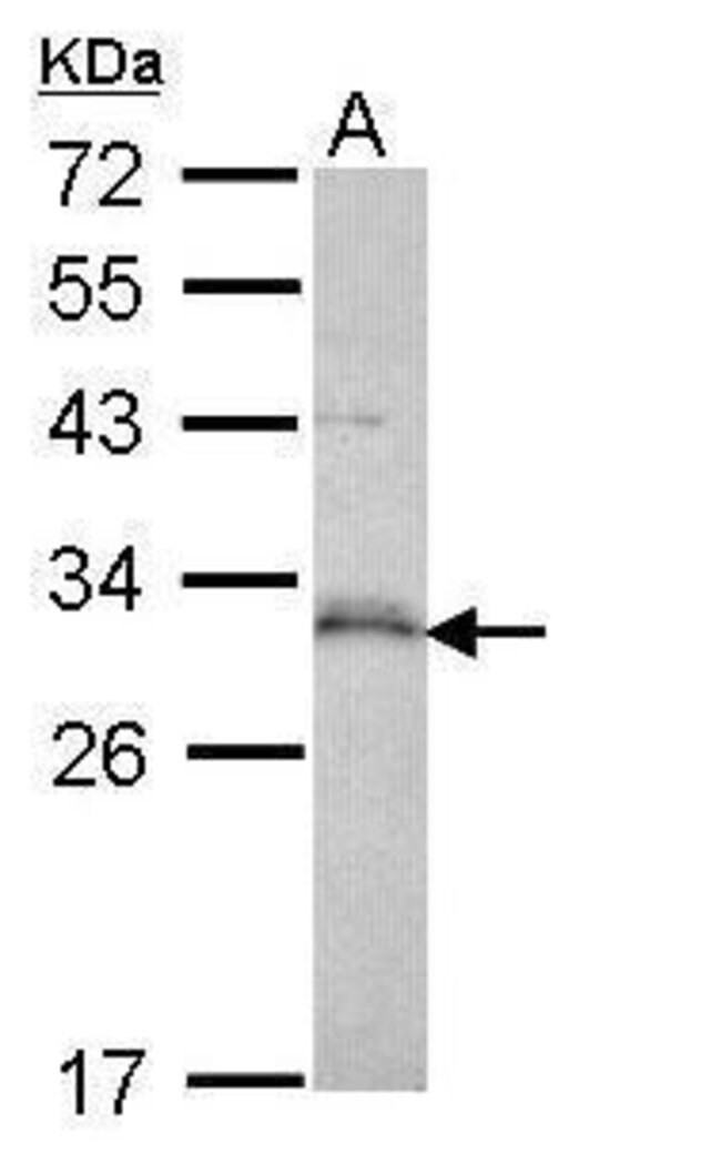 ANTI-P53DINP1