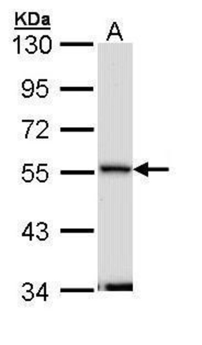 ANTI-SEPTIN 11