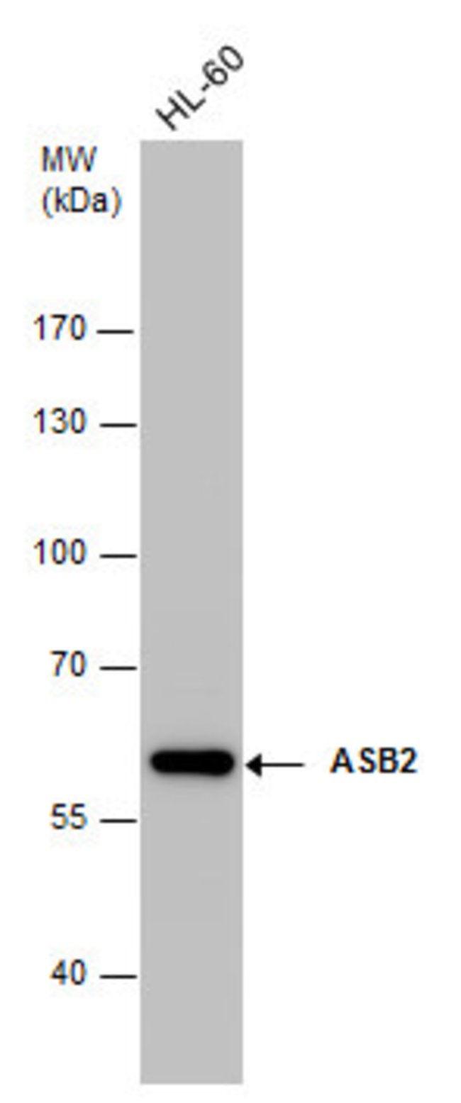 ANTI-ASB2