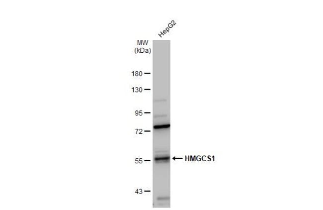 ANTI-HMGCS1