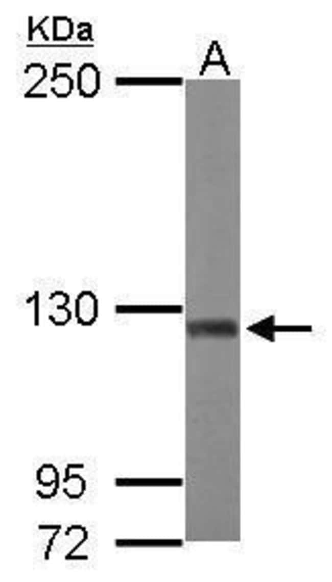 ANTI-ATP CITRATE LYASE