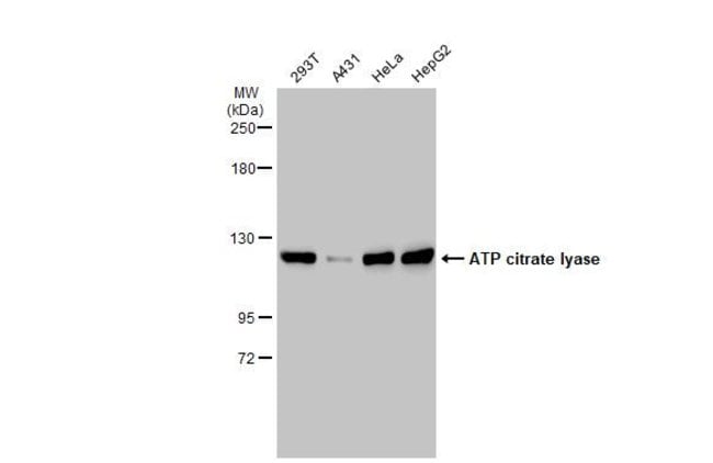 ANTI-ATP CITRATE LYASE