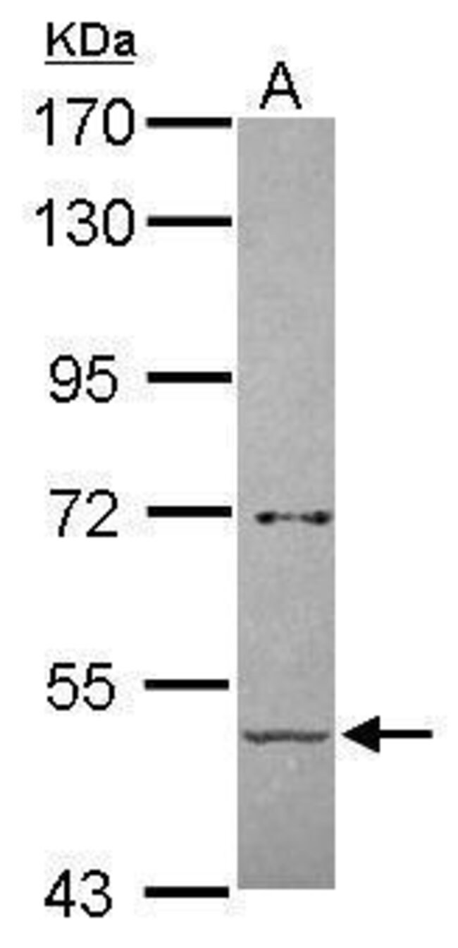 ANTI-ALPHA AMYLASE 2B (PANCREATIC)