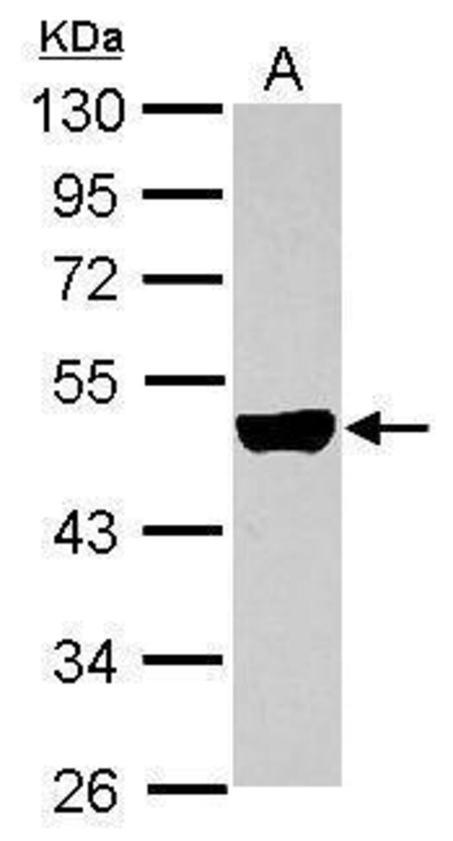 ANTI-CYTOKERATIN 33B