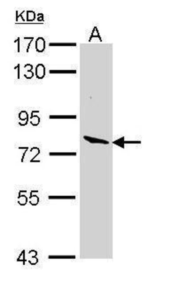 ANTI-LACTOPEROXIDASE