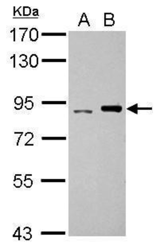 ANTI-DNA POLYMERASE IOTA