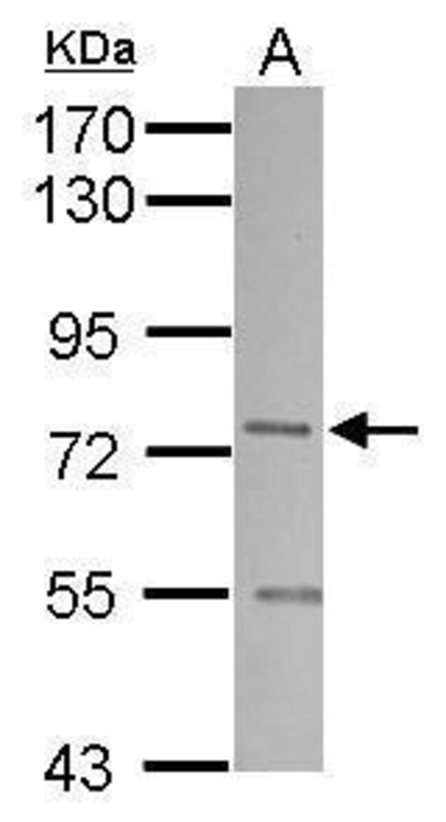 ANTI-SNX1