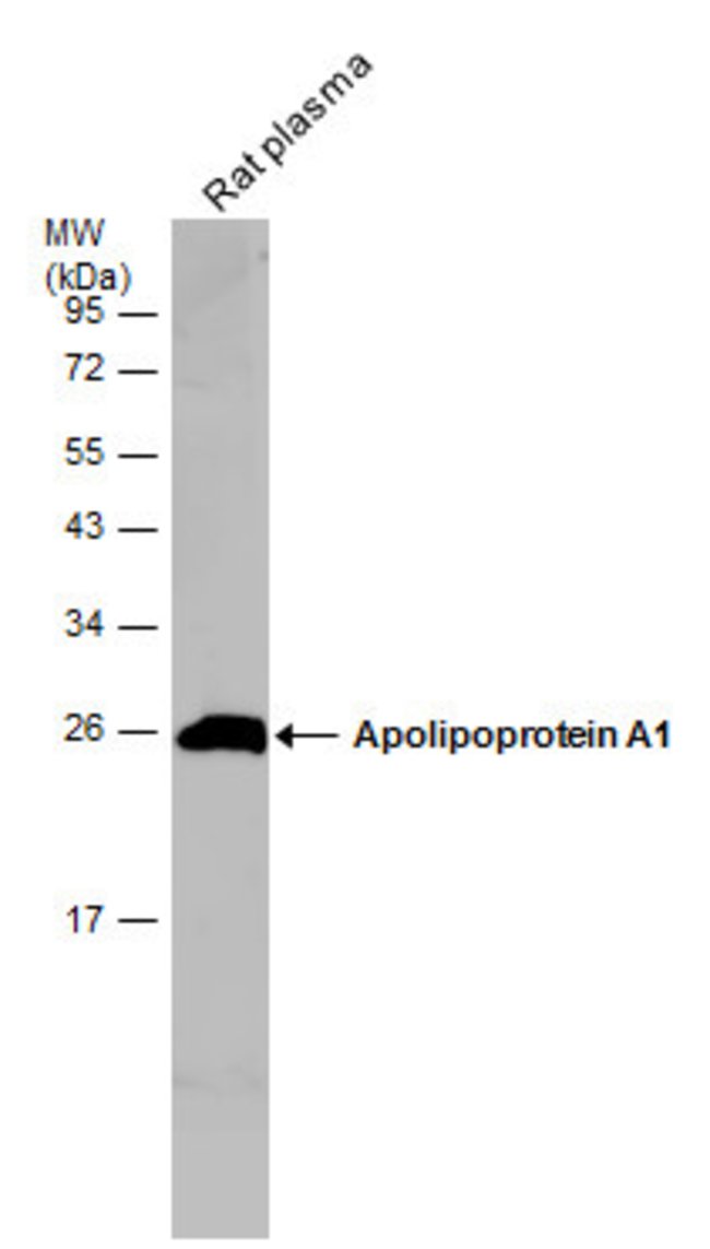 ANTI-APOLIPOPROTEIN A1