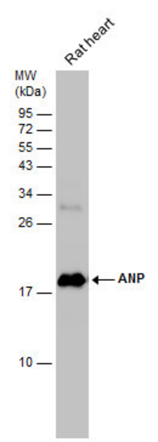 ANTI-ANP