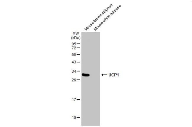 ANTI-UCP1